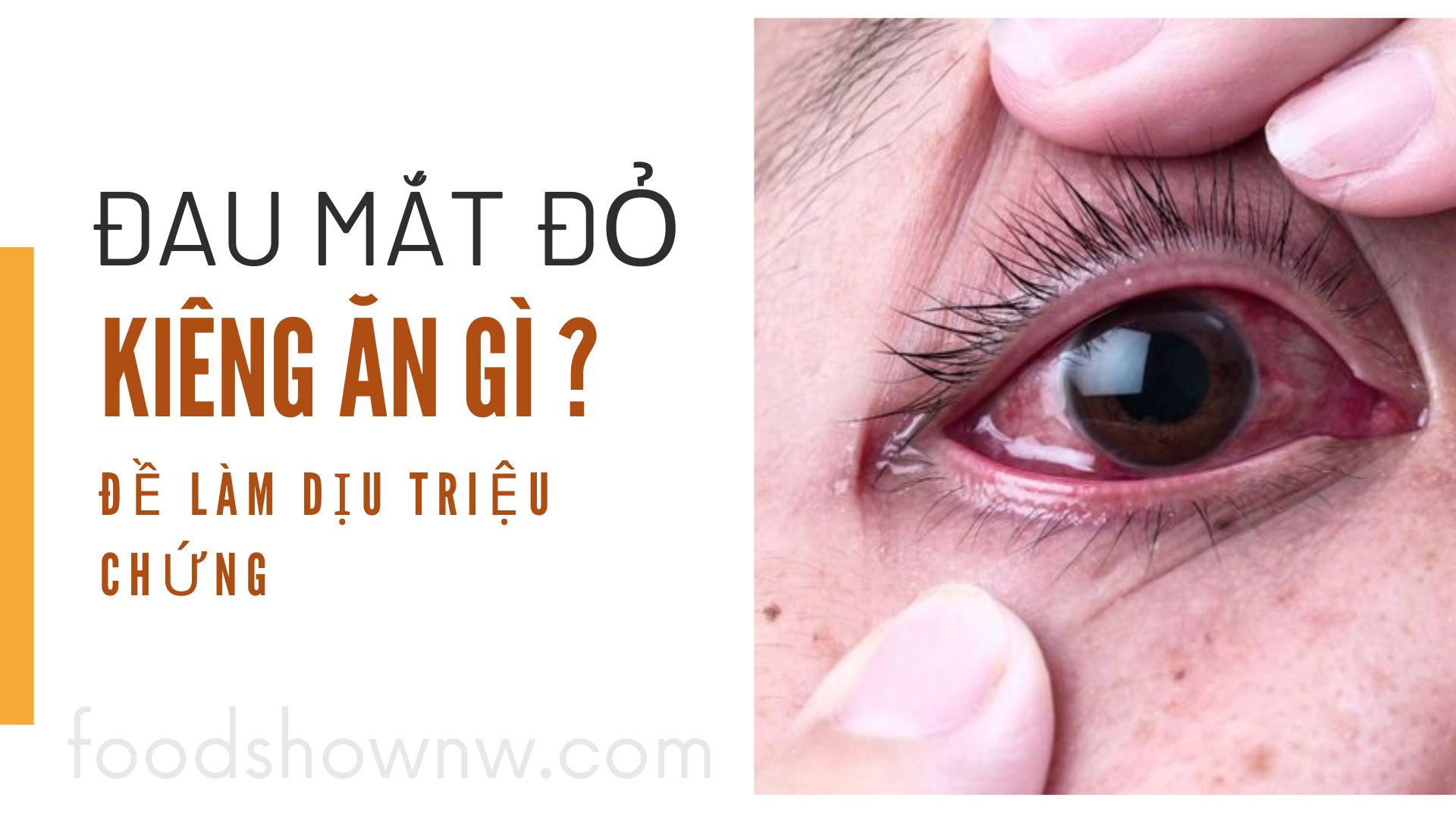 Đau mắt đỏ kiêng ăn gì để làm dịu triệu chứng?